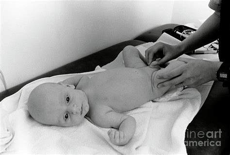Paediatric Examination Of Baby S Testicles Photograph By Henny Allis Science Photo Library Pixels