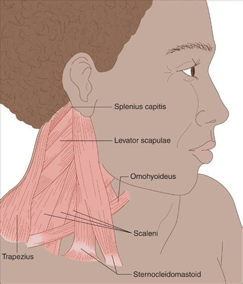 how to treat torticollis in adults