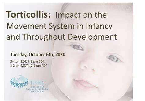 Torticollis Impact On The Movement System 10620 Iprc