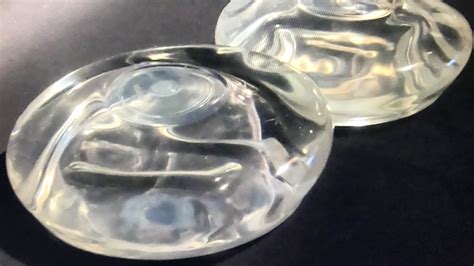Allergan Recalls Textured Breast Implant Tied To Rare Cancer National