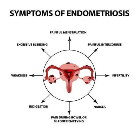 How Endometriosis Can Affect You Over Your Lifetime