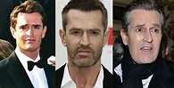 Rupert Everett Plastic Surgery Before and After Pictures 2024