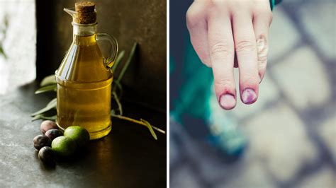 7 Best Essential Oil For Bruises To Soothe Pain Relief