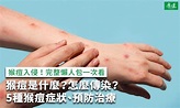 猴痘是什麼？5種猴痘症狀、猴痘疫苗、預防傳染一次看 - 康健雜誌