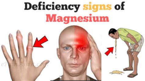 11 Warning Signs Of Magnesium Deficiency That You Should Not Ignore