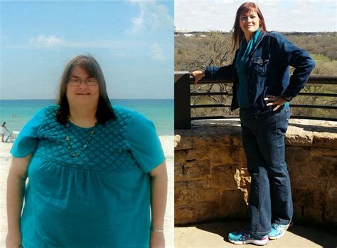 woman s inspiring story of 243 pound weight loss