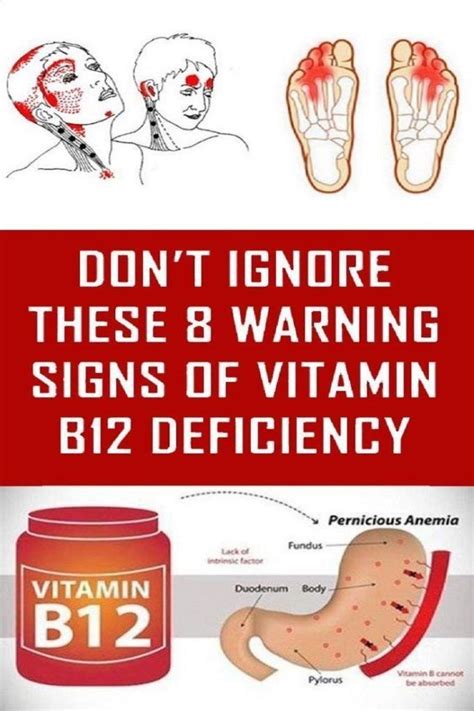 5 Warning Signs Of Vitamin B12 Deficiency You Should Never Ignore Health