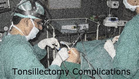 Tonsillectomy Complications Bleeding And Pain Tonsillectomy