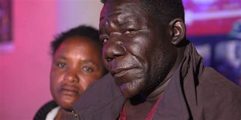 Winner Of Zimbabwes Mr Ugly Pageant Hopes Unusual Honor Will Lead To