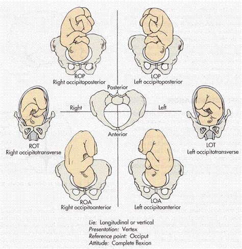 Fetal Positions Rop Lop Roa Loa Newborn Nursing Ob Nursing