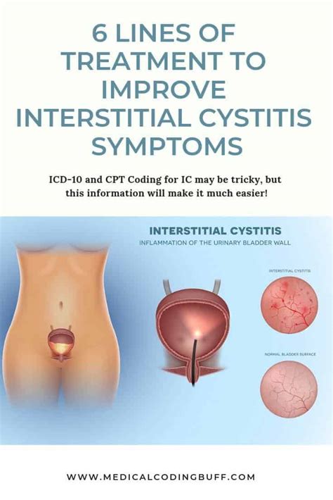 Coding For Interstitial Cystitis Causes Symptoms Diagnosis And Treatment Medical Coding Buff
