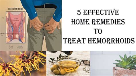5 Effective Home Remedies To Treat Hemorrhoids Youtube