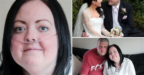 Double Lung Transplant Patient Dies Holding Her Husbands Hand Just