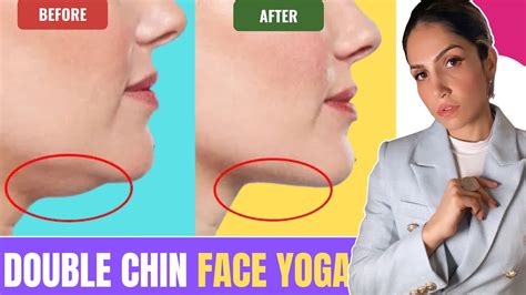 Reduce Double Chin And Get Perfect Jawline With Face Yoga Face Yoga With Palak Youtube