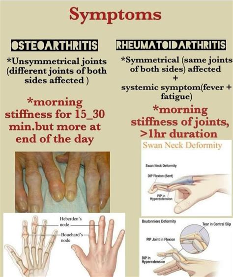Symptoms Osteoarthritis And Rheumatoid Arthritis