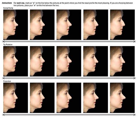 Nose Types Nose Shapes Face And Body Nose Job