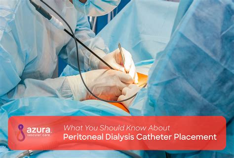 Peritoneal Catheter Placement