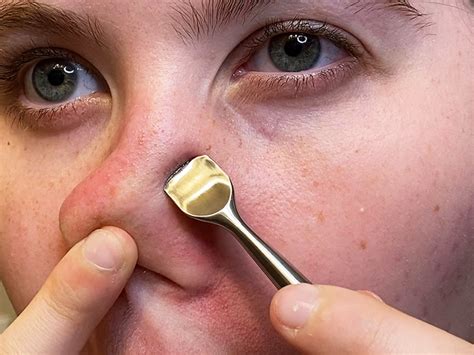 Popping A Pimple In The Triangle Of Death Could Lead To Serious