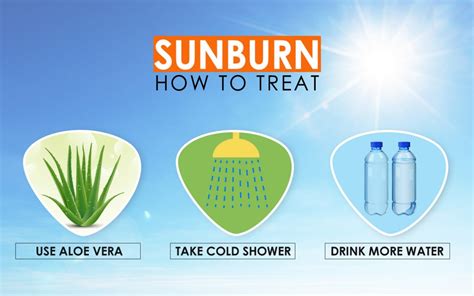 9 Home Remedies To Treat Sunburn Naturally Zameen Blog