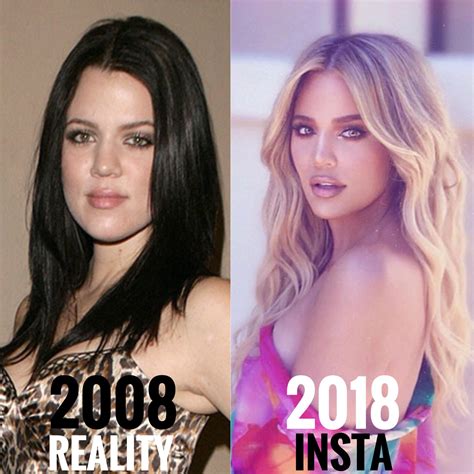 Khloe kardashian reveals exactly what plastic surgery she's had. Khloé Kardashian : Instagramreality