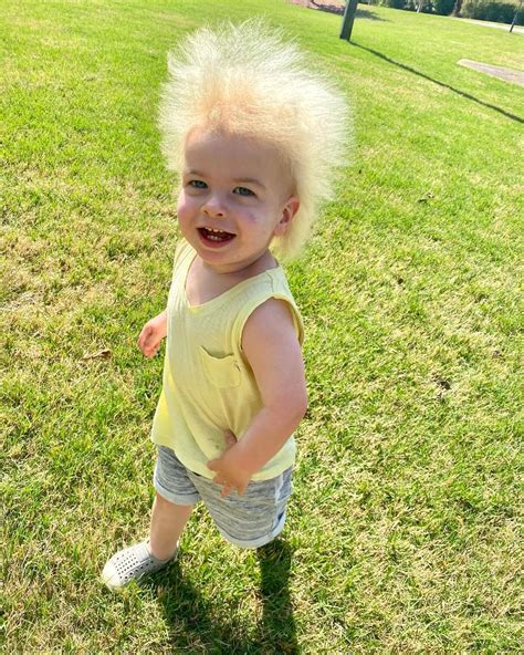 Uncombable Hair Syndrome Is A Rare Genetic Syndrome — And This Little