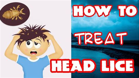 Head Lice Treatment How To Get Rid Of Head Lice Quickly At Home Youtube