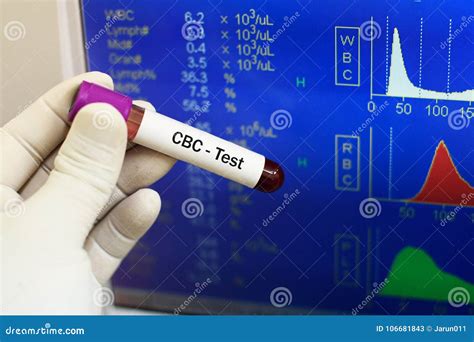 Sangre Para La Prueba Del Cbc Imagen De Archivo Imagen De Cuidado Anemia 106681843