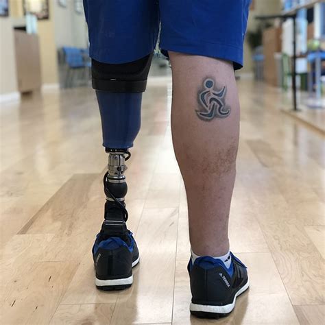 Below Knee Amputee Amputee Prosthetics Prosthetic Leg