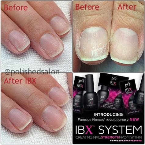 How To Fix Naughty Nails And Crusty Cuticles Polishedca