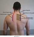 [PDF] Dorsal scapular nerve neuropathy: a narrative review of the ...