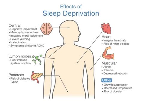 How Sleep Affects Mental Health Expert Guide On Sleep Problems And