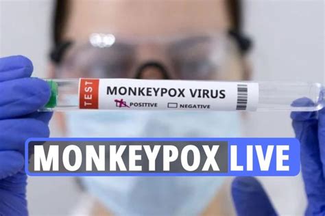 Monkeypox Uk Symptoms Live Virus Outbreak Could Be Tip Of The Iceberg