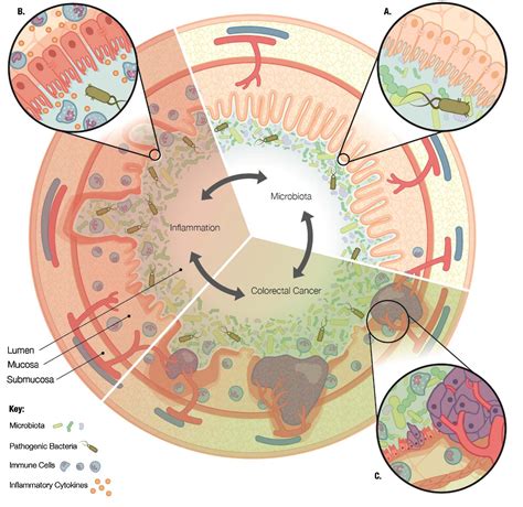 Figure 1 From Microbiome And Colorectal Cancer Unraveling Host