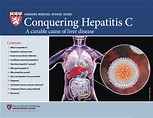 Hepatitis C: What You Should Know | Sunny Pharma