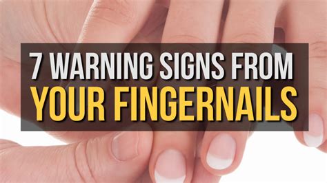 Warning Signs From Your Fingernails Health Babamail