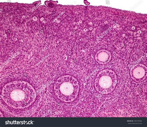 Low Power Micrograph Ovary Showing Ovarian Foto De Stock 185476994