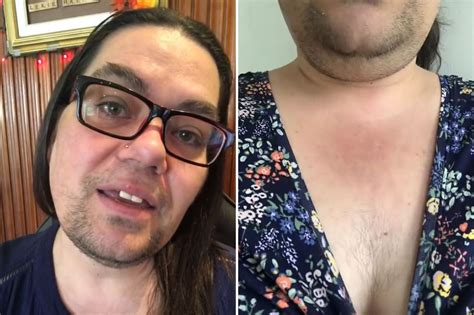 Woman Who Spent DECADES Shaving Her Lady Beard In Shame Is Now