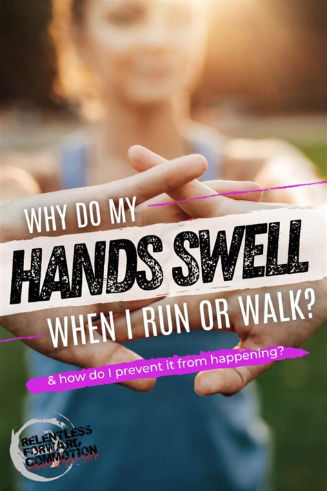 7 Reasons Why Your Hands Swell When Running Or Walking Relentless
