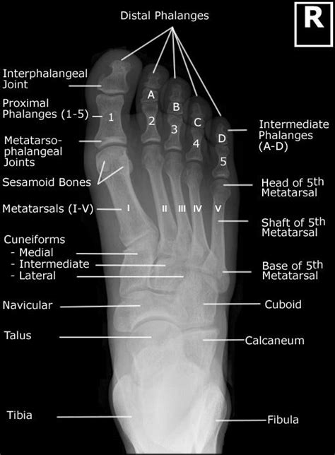 CE RT Radiographic Positioning Of The Distal Feet For X Ray Techs