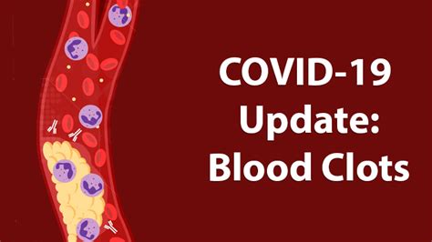 Can Autoimmune Antibodies Explain Blood Clots In Covid 19 Nih