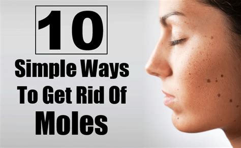 10 Simple Ways To Get Rid Of Moles On Any Part Of The Body Naturally