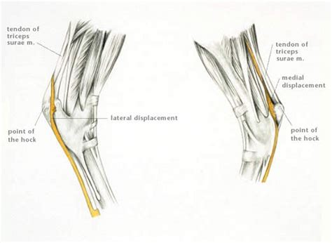 A deep cut on the palm side of your fingers, hand, wrist, or forearm can damage your flexor tendons, which are the. Luxation of the Superficial Digital Flexor Tendon from the ...