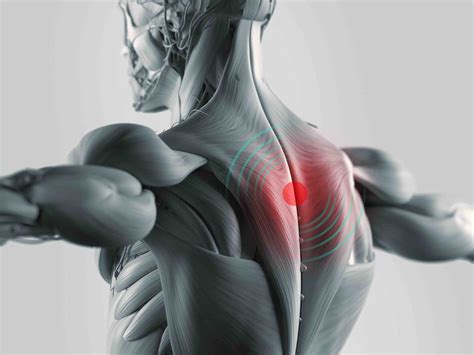 Joint And Muscle Pain Rehabilitation Sports Injuries St Andrews