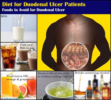 Surgery for peptic ulcers is now performed less often but it is necessary to still be fully aware of nevertheless, there are some elderly patients still alive who have had elective surgery, so it is food unable to move through the bypassed section of bowel, producing a bacterial overgrowth syndrome. Diet for Duodenal Ulcer Patients
