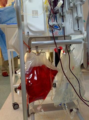 Gambro ak 95 s manual online: Troubleshooting the dialysis circuit | Deranged Physiology