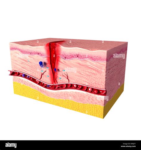 Anatomía De La Reparación Tisular En La Piel Humana Fotografía De Stock