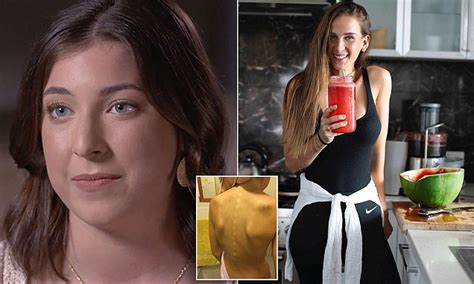 Teen Who Weighed Less Than 40kg Claims Social Media Triggered Her