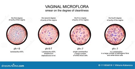 Microflora Vaginal Grado De Pureza De La Vagina Ilustración Del Vector