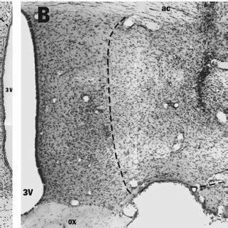 Photomicrographs Of Coronal Sections Through The Preoptic Area Stained