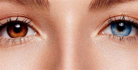 Heterocromia Entenda Sobre Olhos De Cores Diferentes Eyecolors
